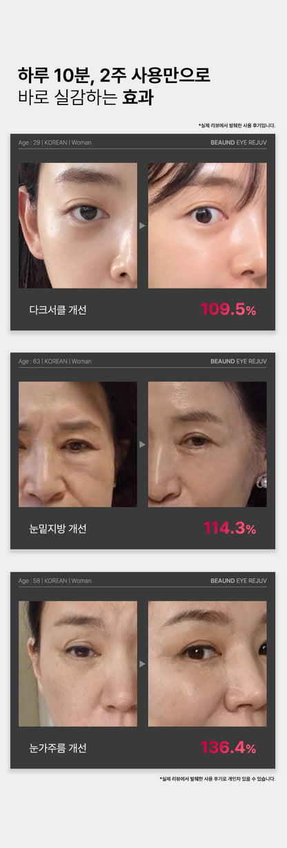 BEAUND - Eye Rejuve (Eye Care Device) [New Launch!]