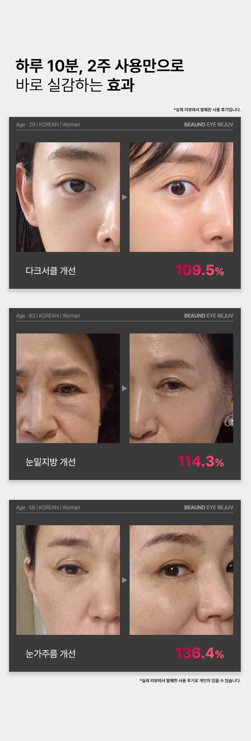 BEAUND - Eye Rejuve (Eye Care Device) [New Launch!]