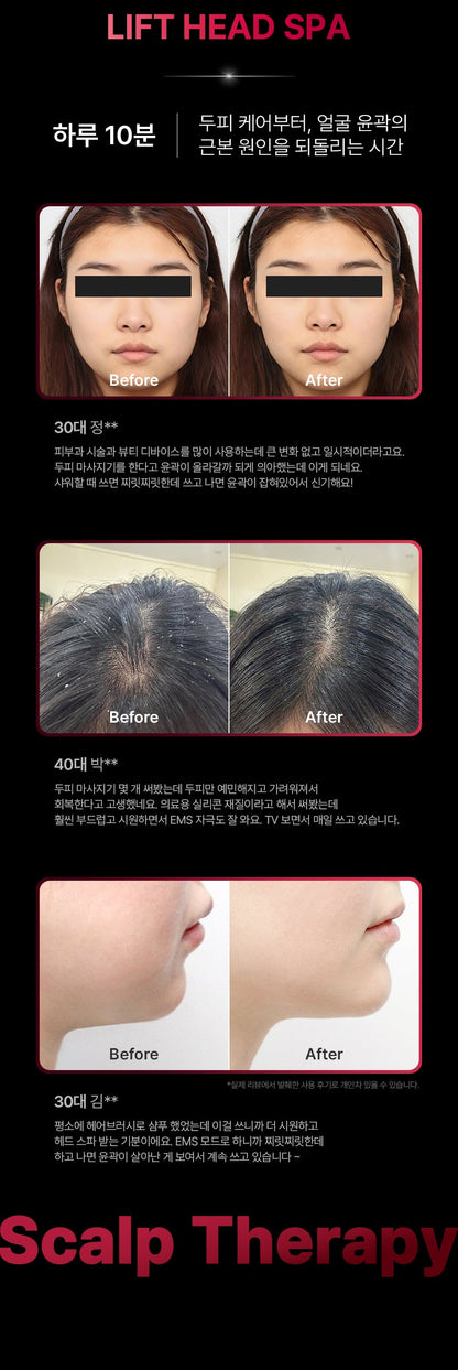 [NEW LAUNCH!] BEAUND - Lift Head Spa