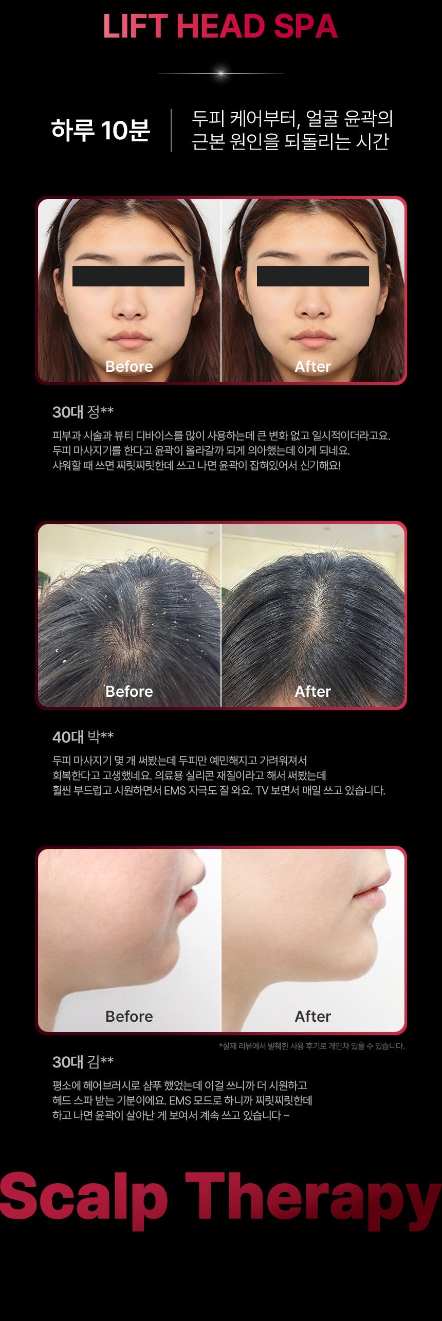 [NEW LAUNCH!] BEAUND - Lift Head Spa