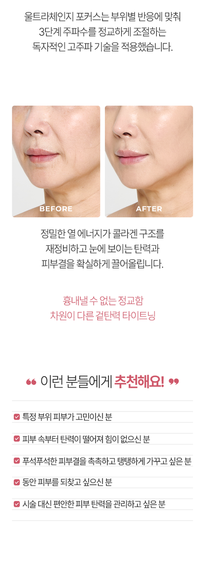 Aalok - ULTRA CHANGE FOCUS – All-in-One Home Beauty Device