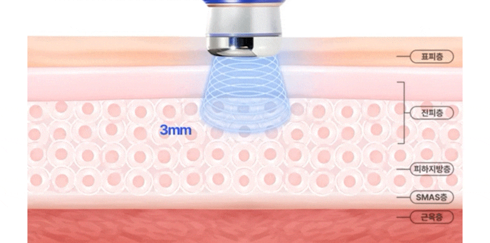 OLLIVIA - The Orlier S1 Beauty Device (Facial Contour & Lifting Care)