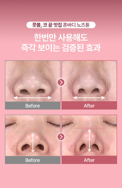 HONBODY - Nose Tune (Beauty Device)