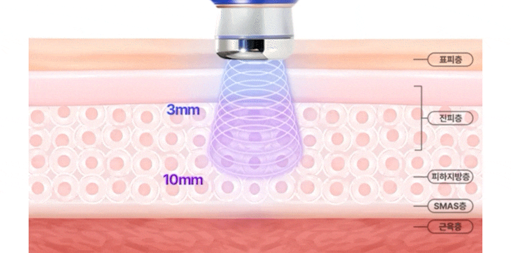 OLLIVIA - The Orlier S1 Beauty Device (Facial Contour & Lifting Care)
