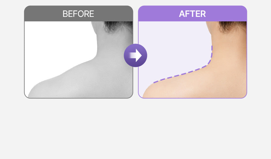 [BALANCE FIT] - Neck & Shoulder Massager