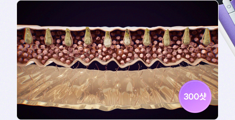 EOA - FULTENZA Premium Lifting Beauty Device [New Launch!]