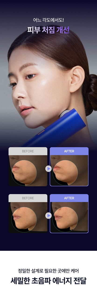 OLLIVIA - The Orlier S1 Beauty Device (Facial Contour & Lifting Care)