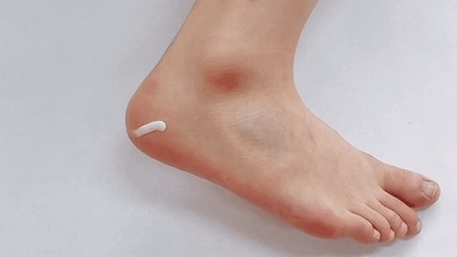 Dermagen - Urea Cream (Skin Softener)