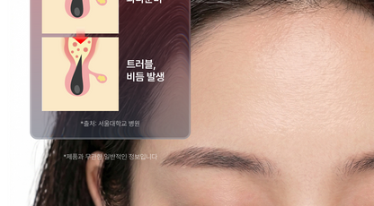 lilyeve - Scalp Turn Cica PDRN Deep Clean Shampoo 500g + 100g + Jigglypuff Pouch (Pokémon Collaboration)