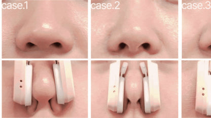 HONBODY - Nose Tune (Beauty Device)