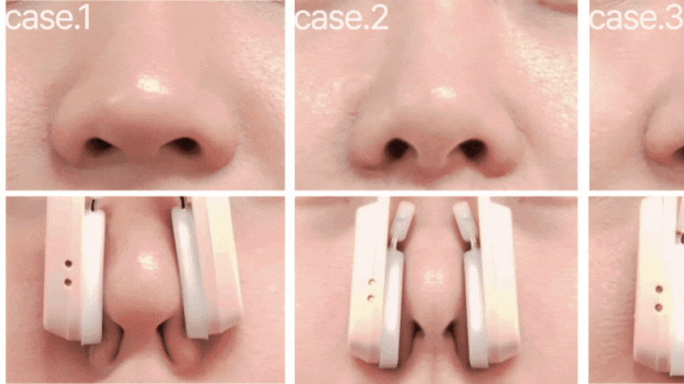 HONBODY - Nose Tune (Beauty Device)