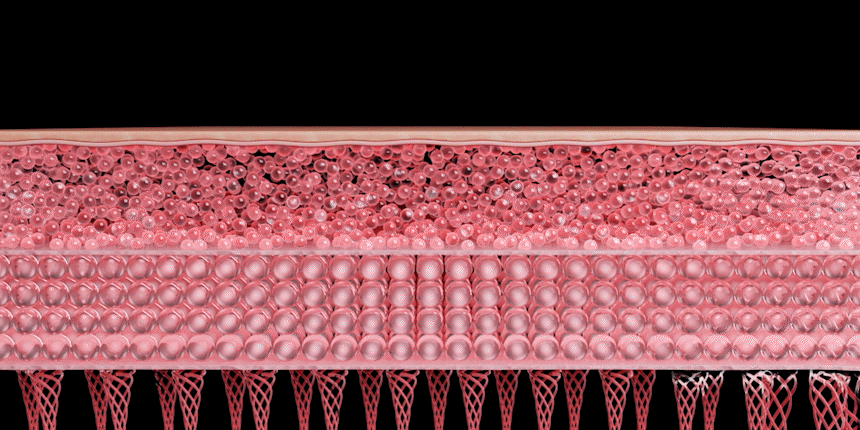 THERMATHERA - Unlimited-Shot HIFU Beauty Device [New Launch!]