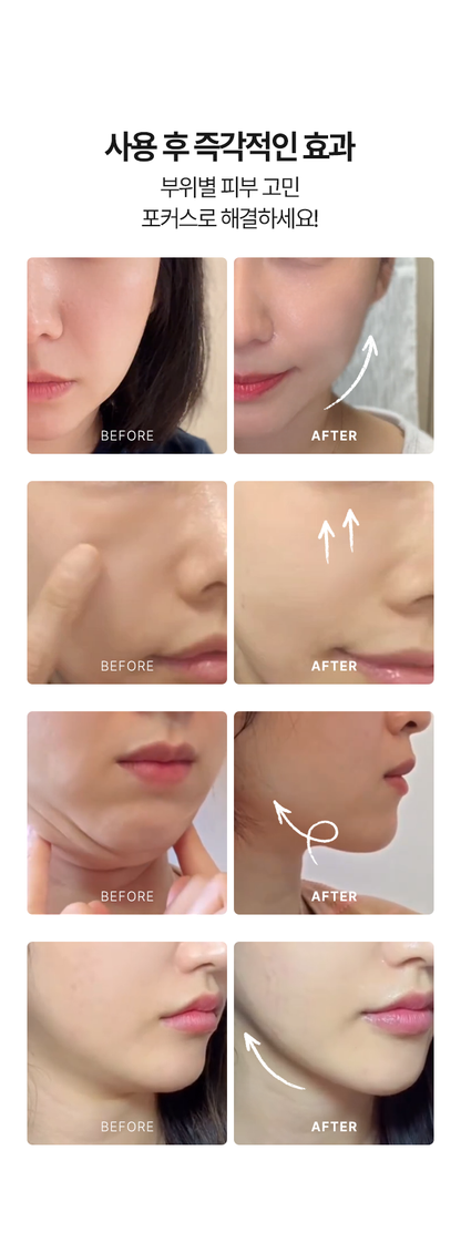 Aalok - ULTRA CHANGE FOCUS – All-in-One Home Beauty Device