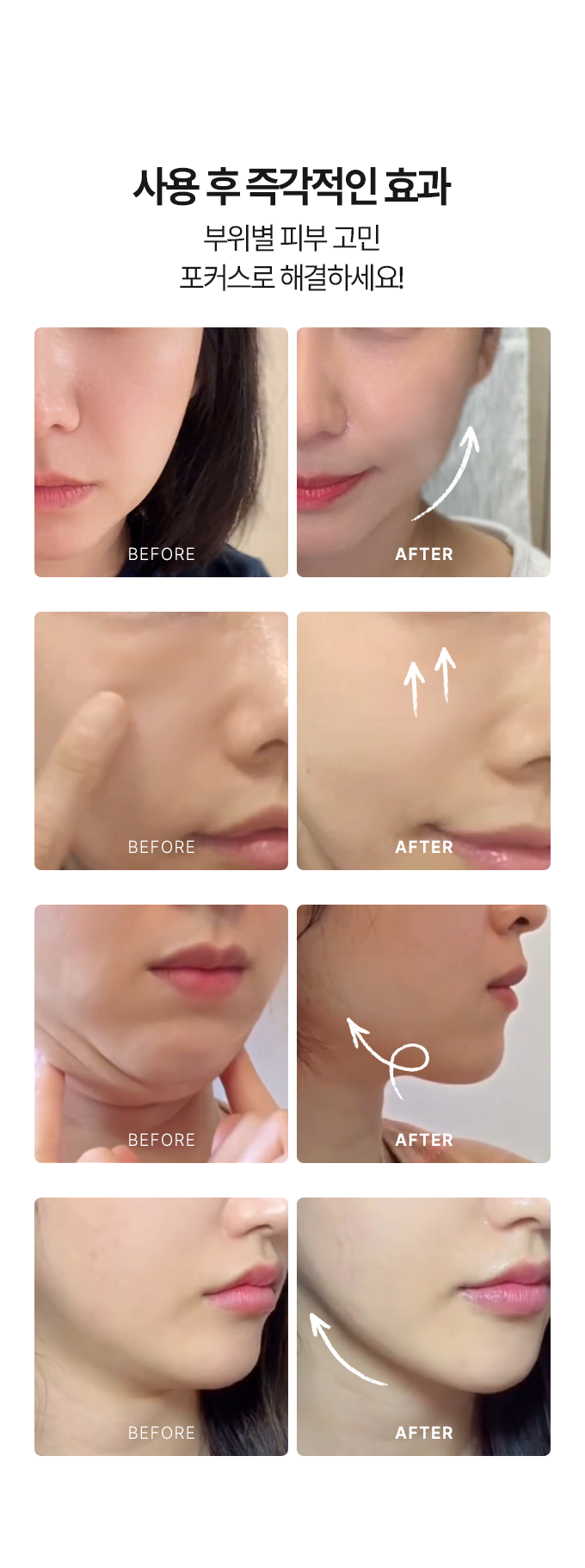 Aalok - ULTRA CHANGE FOCUS – All-in-One Home Beauty Device