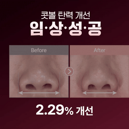 HONBODY - Nose Tune (Beauty Device)