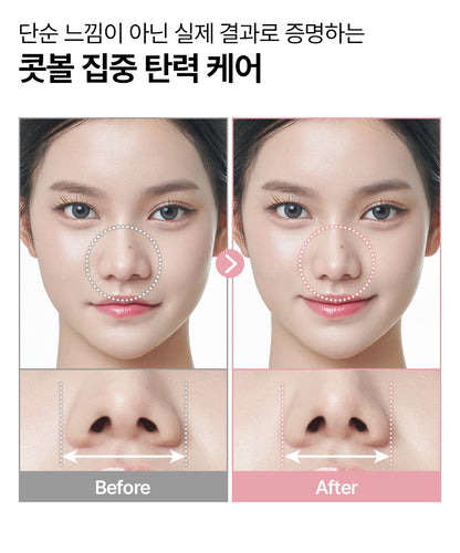 HONBODY - Nose Tune (Beauty Device)