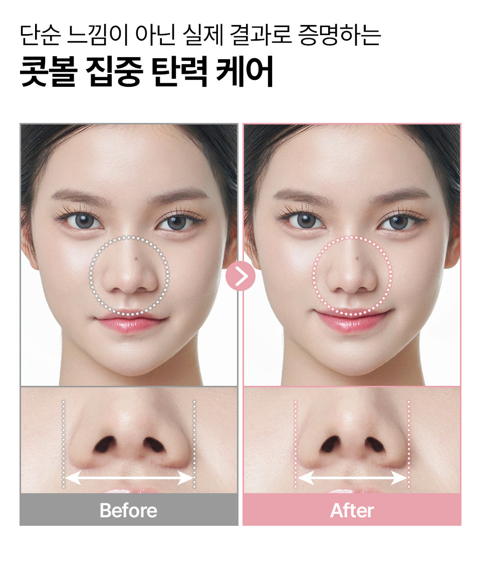 HONBODY - Nose Tune (Beauty Device)