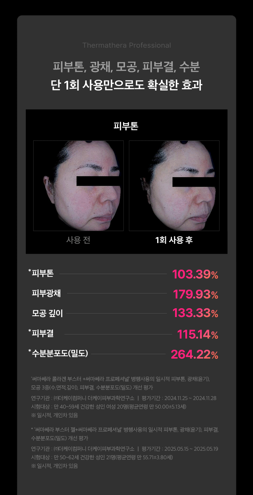 THERMATHERA - Unlimited-Shot HIFU Beauty Device [New Launch!]