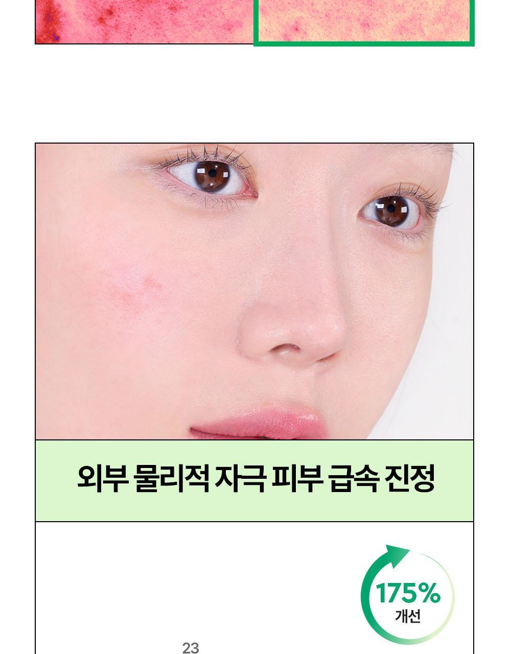 DEWYTREE - AC Deep Calming Mask 10+1 Sheets + Pokémon Sticker (Pokémon Collaboration)