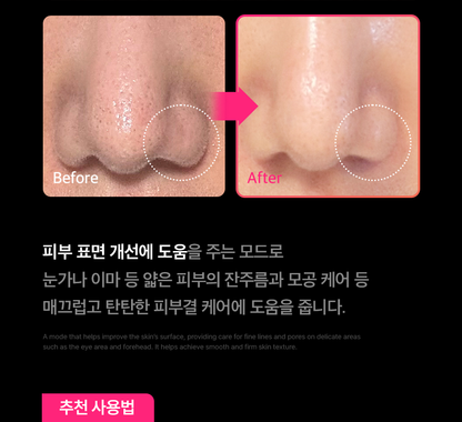 THERMATHERA - Unlimited-Shot HIFU Beauty Device [New Launch!]