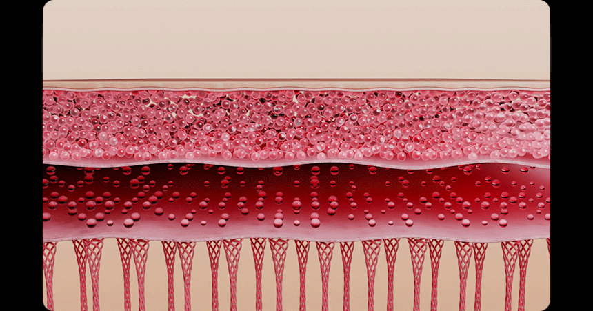 THERMATHERA - Unlimited-Shot HIFU Beauty Device [New Launch!]