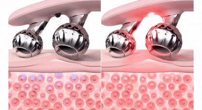 HONBODY - Big Roller Pro EMS Face & Body Massager