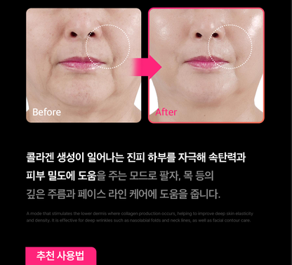 THERMATHERA - Unlimited-Shot HIFU Beauty Device [New Launch!]