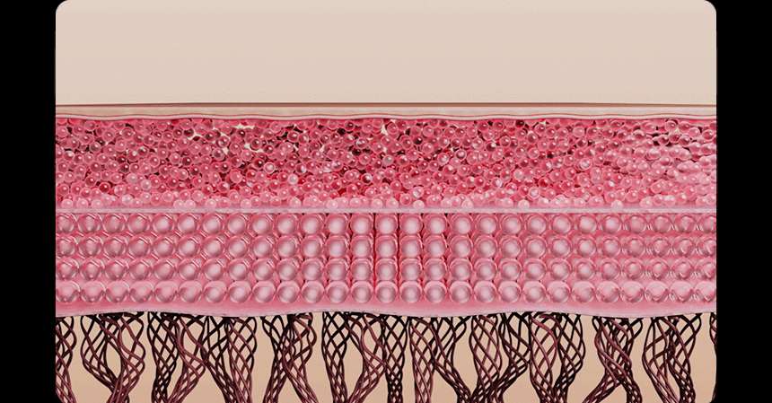 THERMATHERA - Unlimited-Shot HIFU Beauty Device [New Launch!]