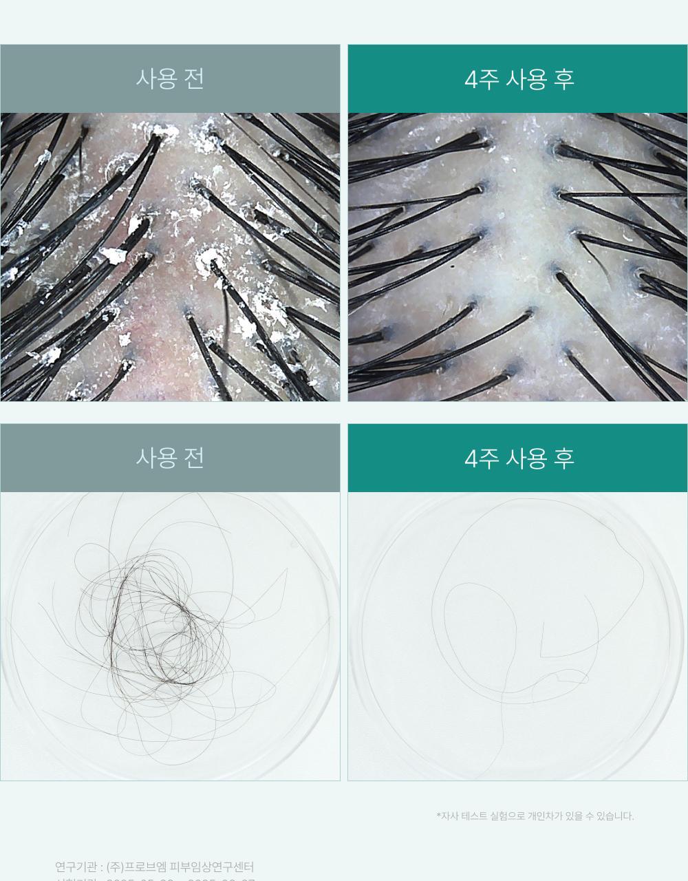 lilyeve - Scalp Turn Cica PDRN Brush Ampoule 100ml + 30ml + Jigglypuff Brush (Pokémon Collaboration)