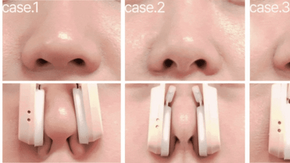 HONBODY - Nose Tune (Beauty Device)