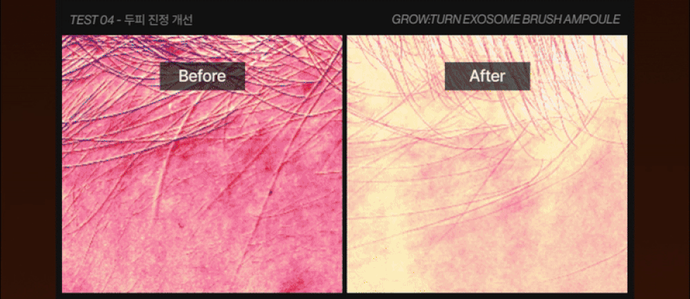 lilyeve - Grow Turn Exosome Brush Ampoule 100ml + 30ml + Charmander Brush (Pokémon Collaboration)