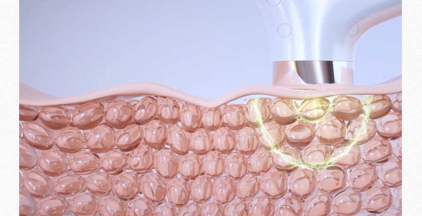 DUALTETRA HALO Beauty Device [New Launch!]