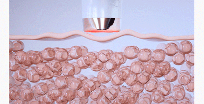 DUALTETRA HALO Beauty Device [New Launch!]