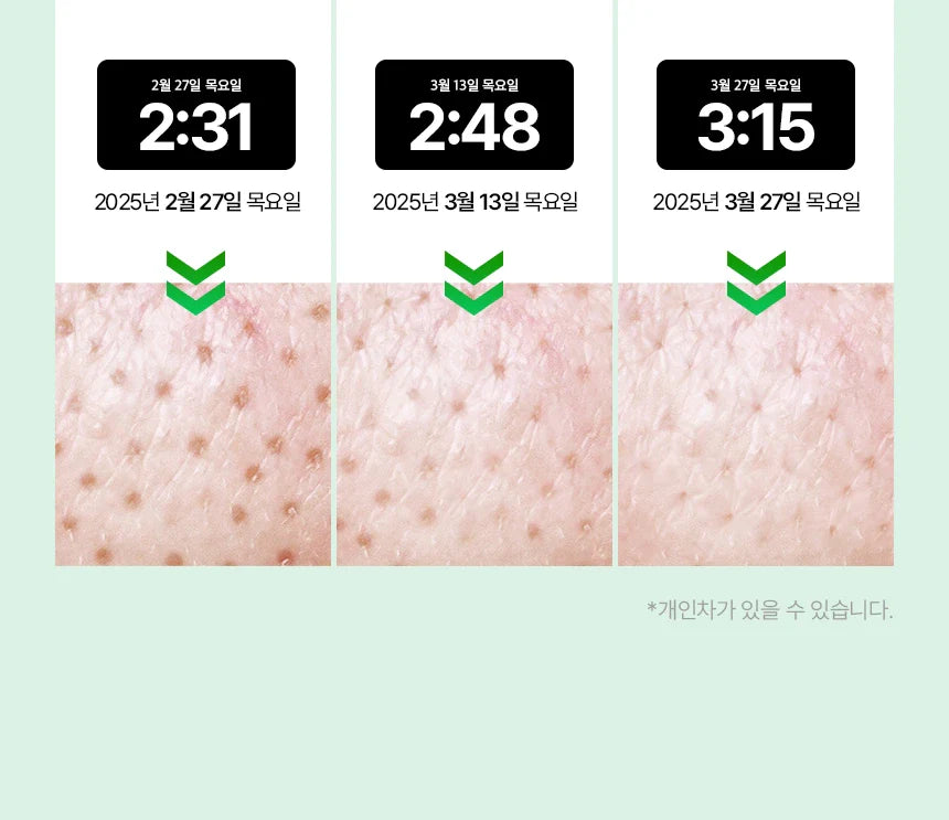 VUDE - Ultra-Low Molecular Diva Shot (Pore Care Beauty Device)