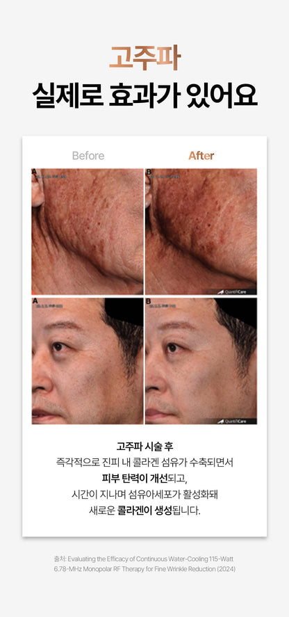 CLABIANE - Oligihome Beauty Device