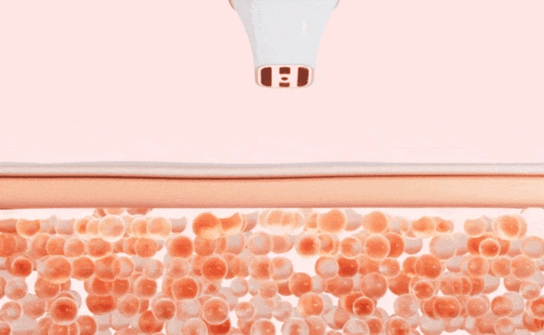 CLABIANE - Oligihome Beauty Device