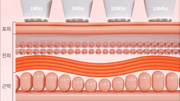 CLABIANE - Oligihome Beauty Device