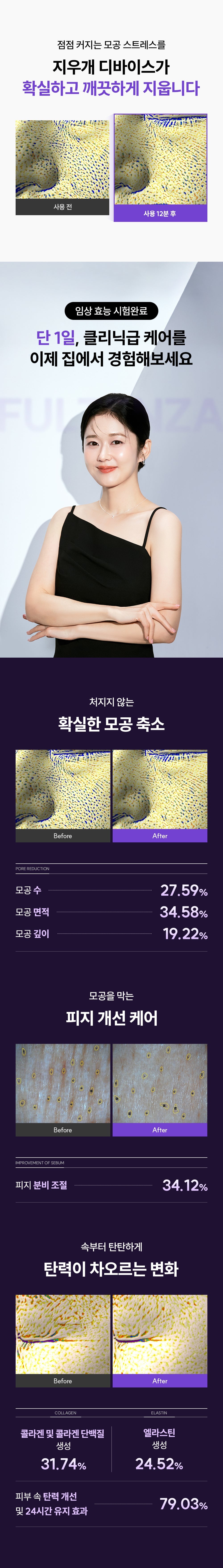 EOA - FULTENZA Premium Lifting Beauty Device [New Launch!]