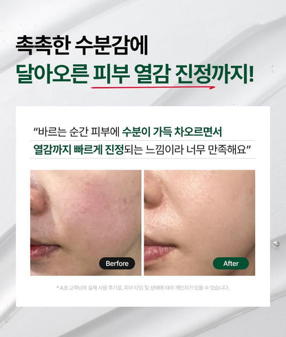 Dr.G - Red Blemish Clear Hyal-Cica Soothing Serum 50ml + Refill + Squirtle Pouch (Pokémon Collaboration)