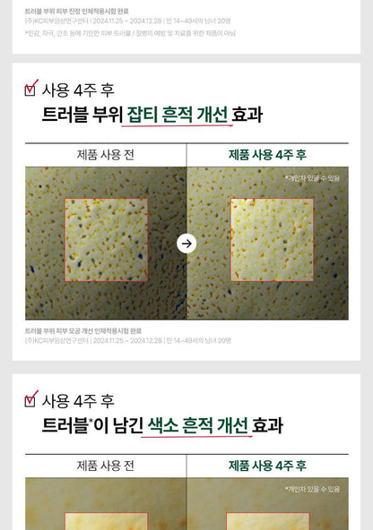 Dr.G - Red Blemish Clear Hyal-Cica Soothing Serum 50ml + Refill + Squirtle Pouch (Pokémon Collaboration)
