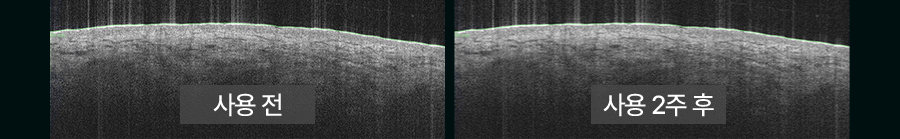 BodyCut - TuneFit V2 ICE Edition (Cooling & Firming Body Care)