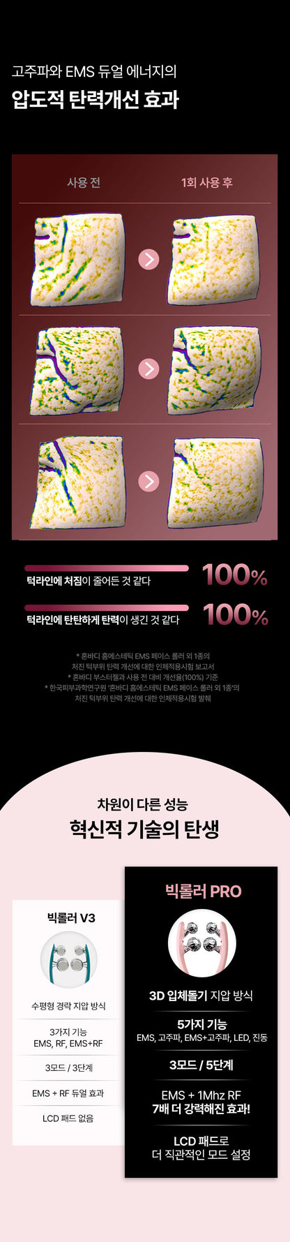 HONBODY - Big Roller Pro EMS Face & Body Massager