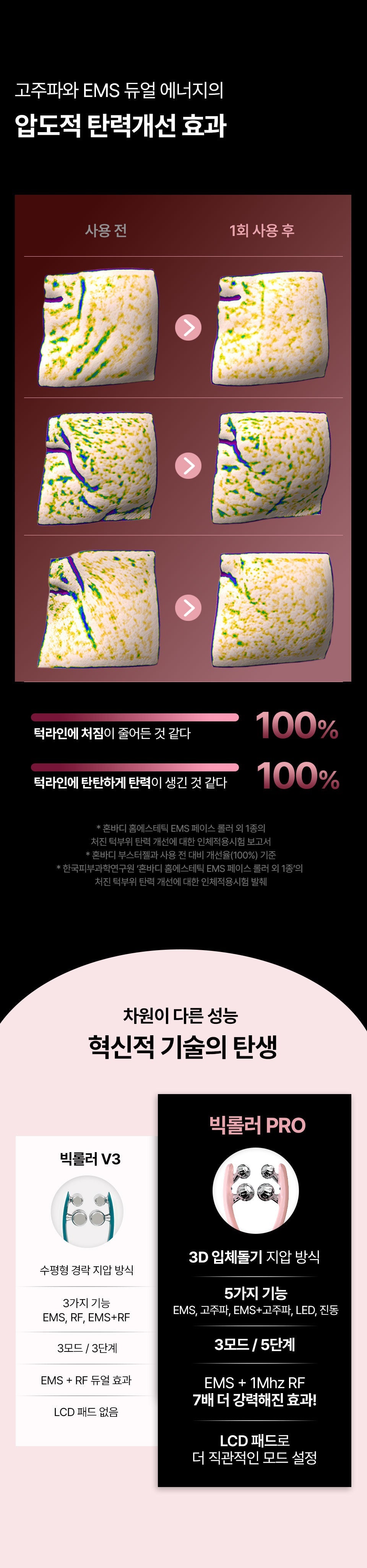 HONBODY - Big Roller Pro EMS Face & Body Massager