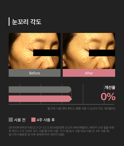 LUKINS - Pro Beauty Device [New Launch!]