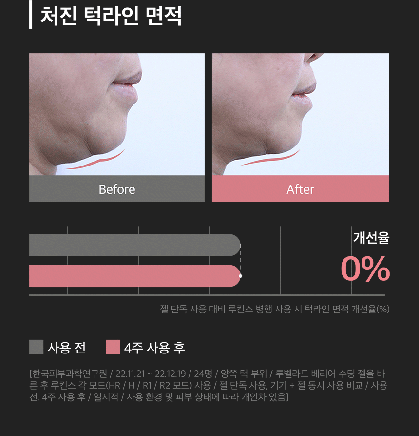 LUKINS - Pro Beauty Device [New Launch!]