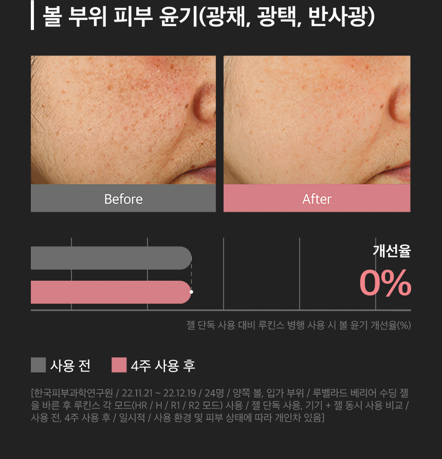 LUKINS - Pro Beauty Device [New Launch!]