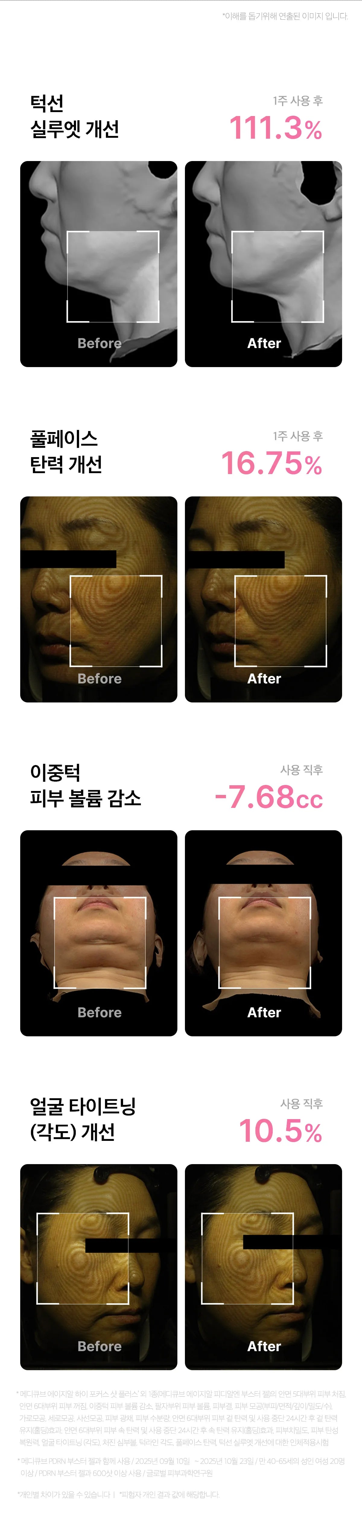 MEDICUBE - AGE-R High Focus Shot Plus (New Launch!)