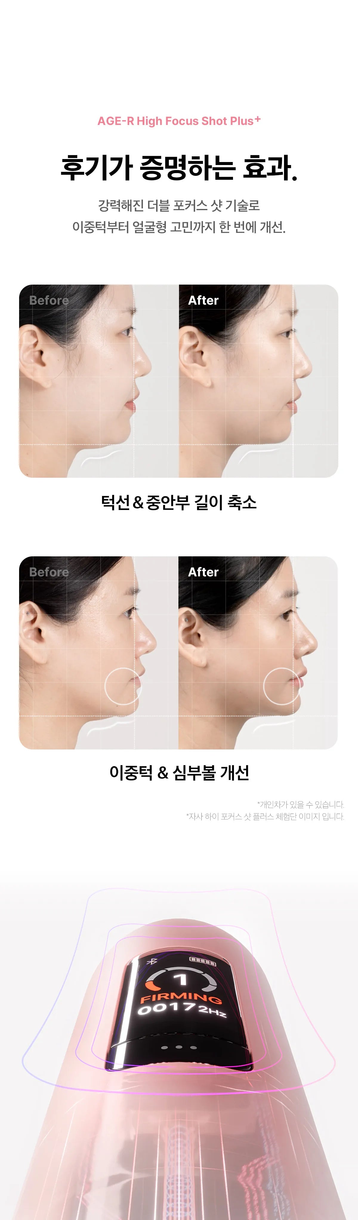 MEDICUBE - AGE-R High Focus Shot Plus (New Launch!)