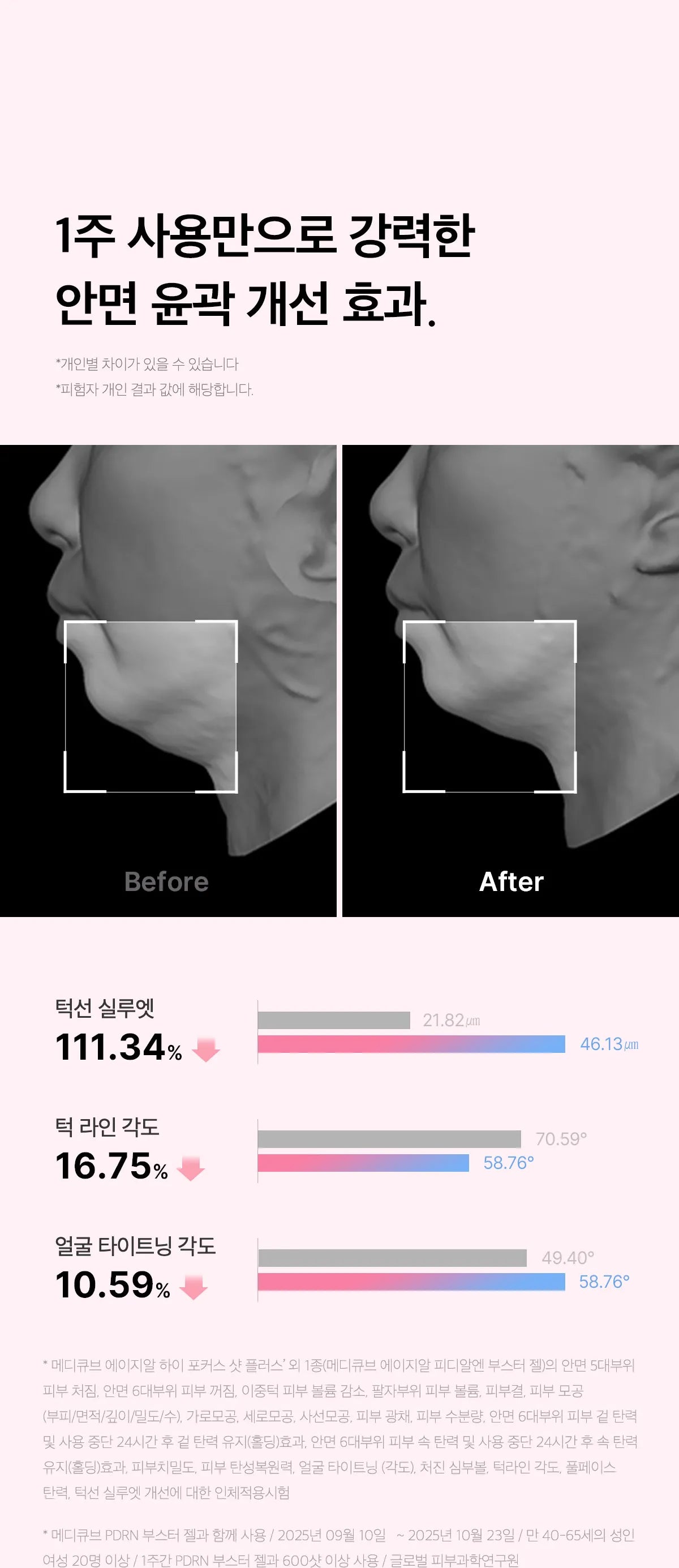 MEDICUBE - AGE-R High Focus Shot Plus (New Launch!)