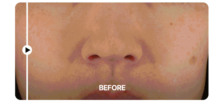 Centellian24 - Madeca Prime Max (Hyper Lifting & Firming Beauty Device)